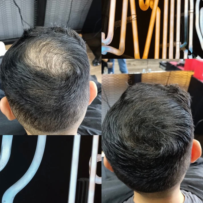 Full Kit Fibras Capilares + Shampoo Control Caída